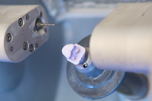 Same Day Dentistry: A New Smile Now  With Same Day Crowns